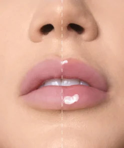 102 LIPOLOGY MESAUDA.webp